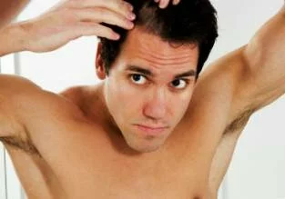 Выпадение волос у мужчин - фото